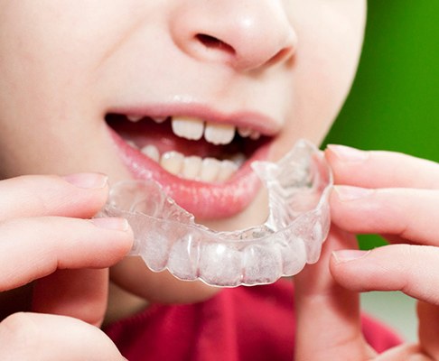 A boy putting on an athletic mouthguard