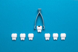 Concept of a baby tooth extraction with forceps